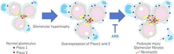 A new mechanism of diabetic kidney disease progression by Piezo proteins: mediators between mechanical stimuli and fibrosis