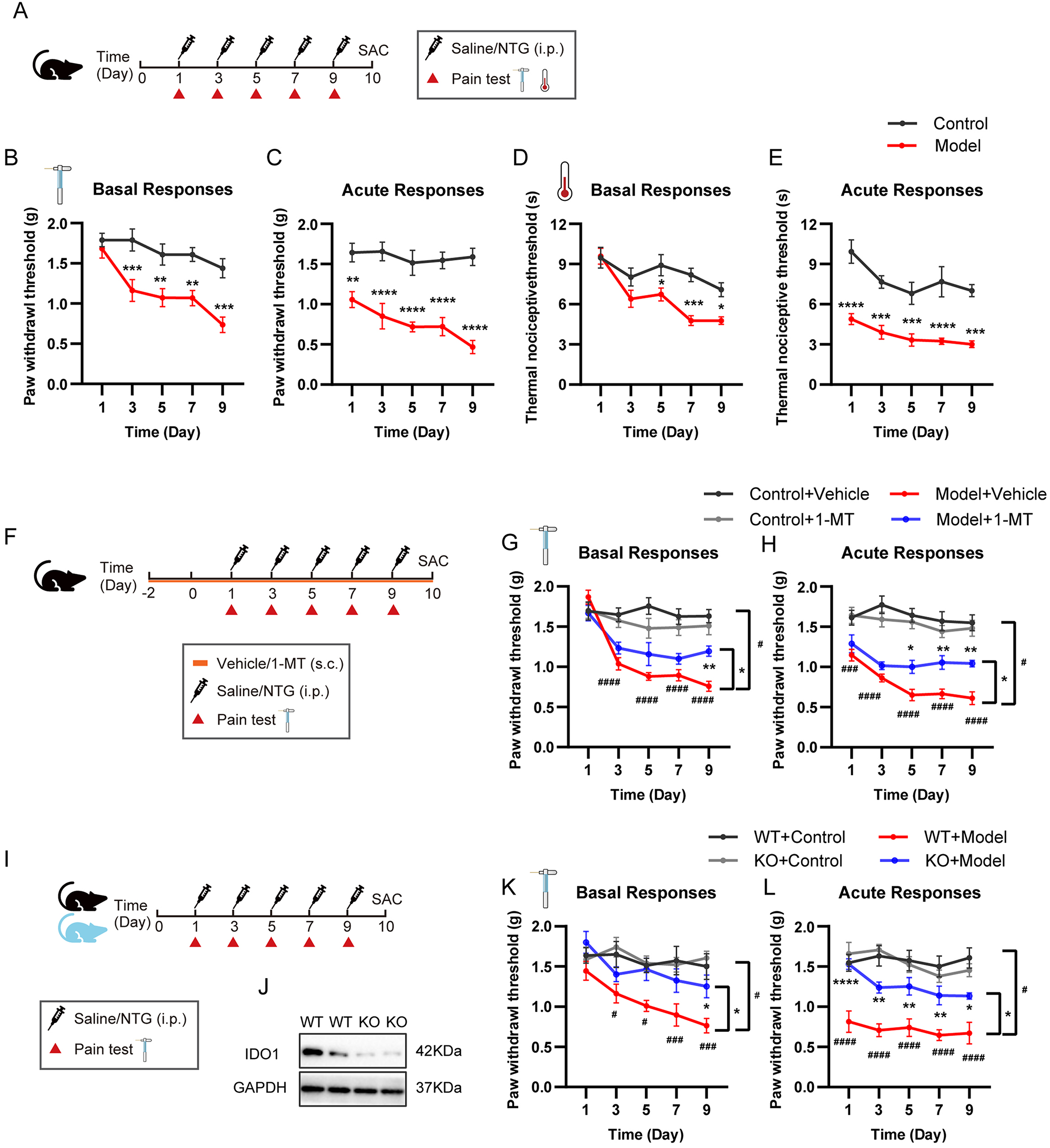 IDO1 modulates pain sensitivity and comorbid anxiety in chronic migraine through microglial activation and synaptic pruning