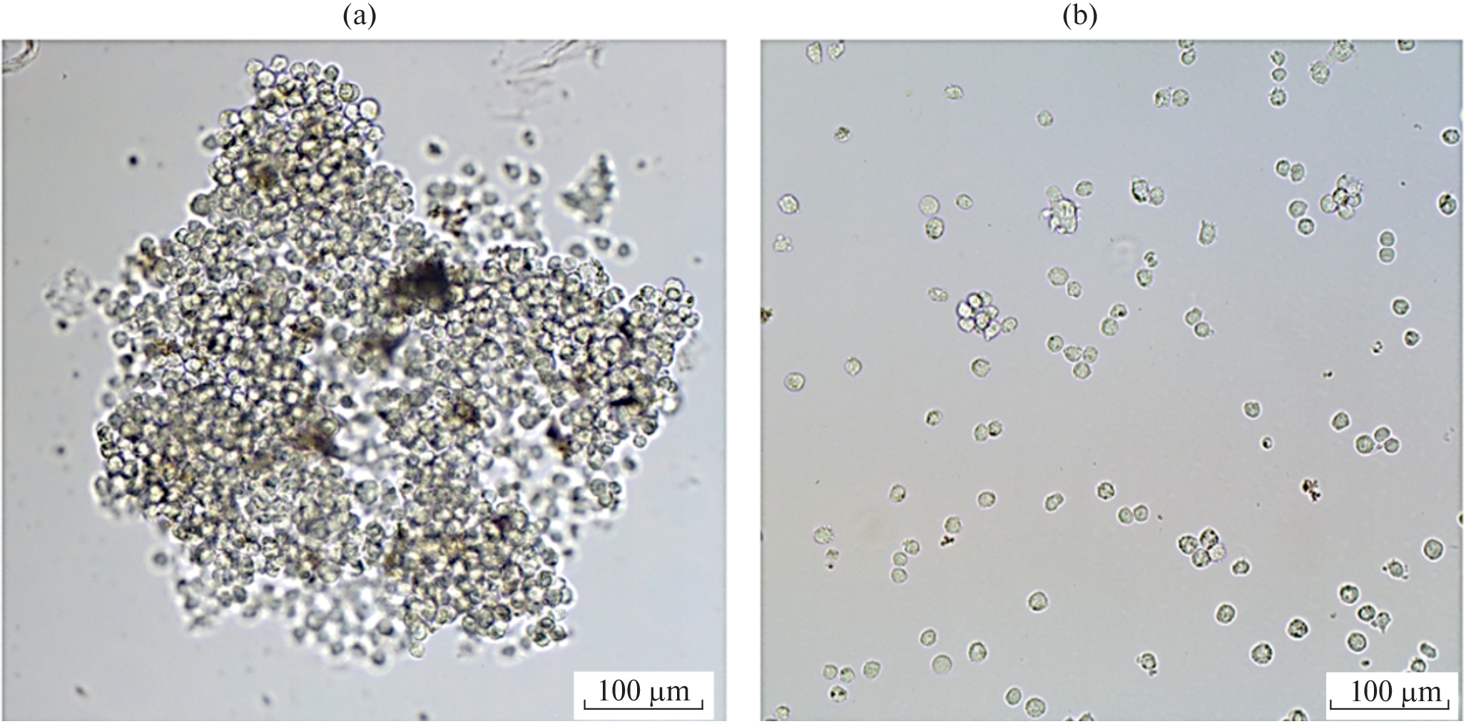 Resistance of CD33+ Acute Myeloid Leukemia Cells to Anthracyclines in Three-Dimensional Cultures