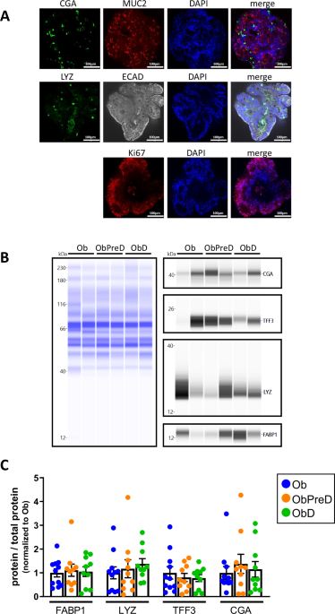 Characterization of jejunal enteroids in human obesity; a model for studying GLP-1 cells