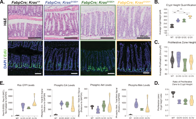 The impact of K-Ras Gly12 mutants on homeostasis and tumorigenesis in the colonic epithelium