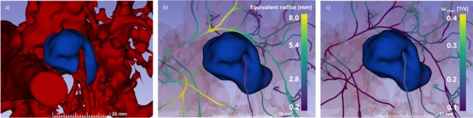 Personalization of liver microwave ablation simulation