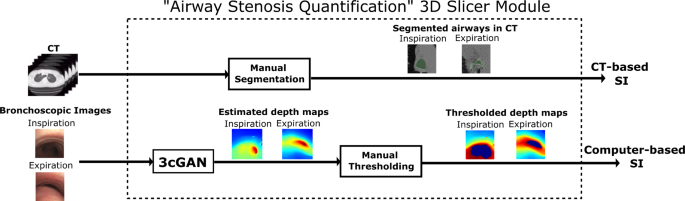 Clinical feasibility study of generative depth estimation to diagnose airway stenosis using 3D slicer