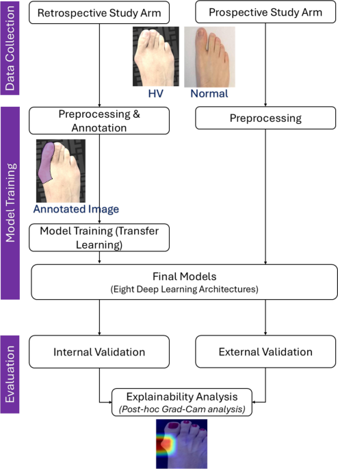 Evaluation of Explainable Deep Learning Models for Clinical Image-Based Screening of Hallux Valgus