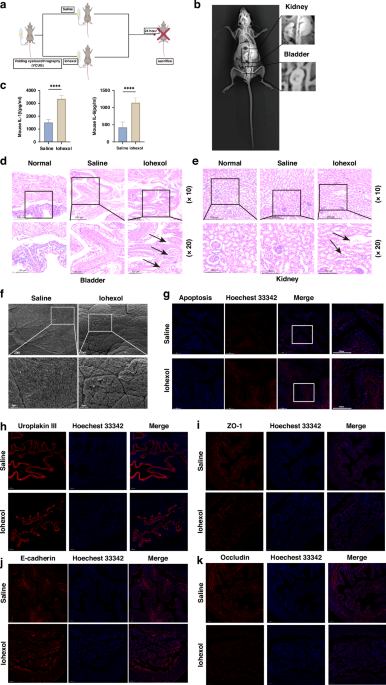 Urothelial barrier alterations and urinary tract infection susceptibility after voiding cystourethrography: evidence from pediatric cohorts and experimental models