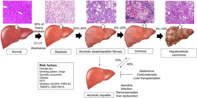 Interaction of Serum Trace Elements and Vitamins in Relation to Liver Enzyme Activities in Patients With Alcoholic Liver Disease