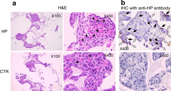 A model of  infection using an artificial liver constructed by a radial-flow bioreactor