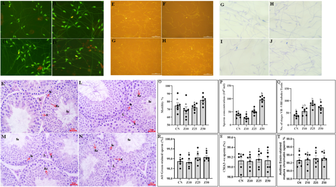 Zingerone supplementation stimulates germ cell proliferation, inhibits apoptosis and modulates autophagy and ferroptosis in the mice testis