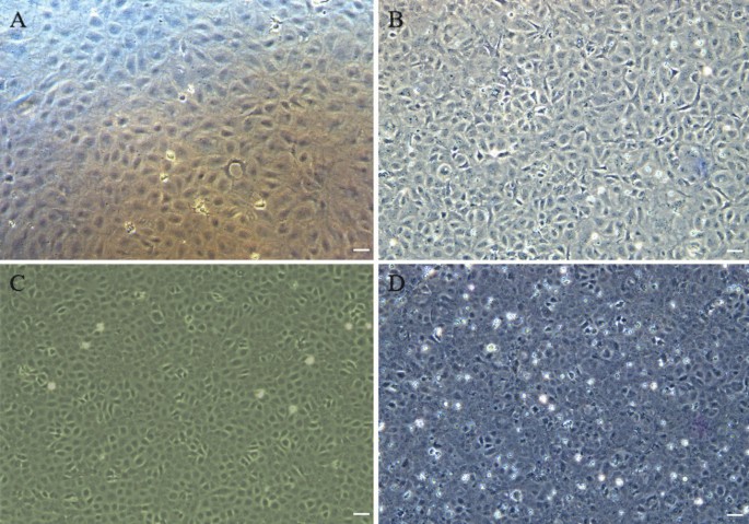Establishment and characterization of an ovarian cell line from red seabream () and its application in fish toxicology
