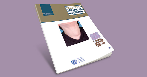 Investigation and management of papillary thyroid microcarcinoma – a Scottish regional case series and literature review