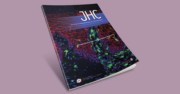Improvement in Double Staining With Fluoro-Jade C and Fluorescent Immunostaining: FJC Staining Is Not Specific to Degenerating Mature Neurons