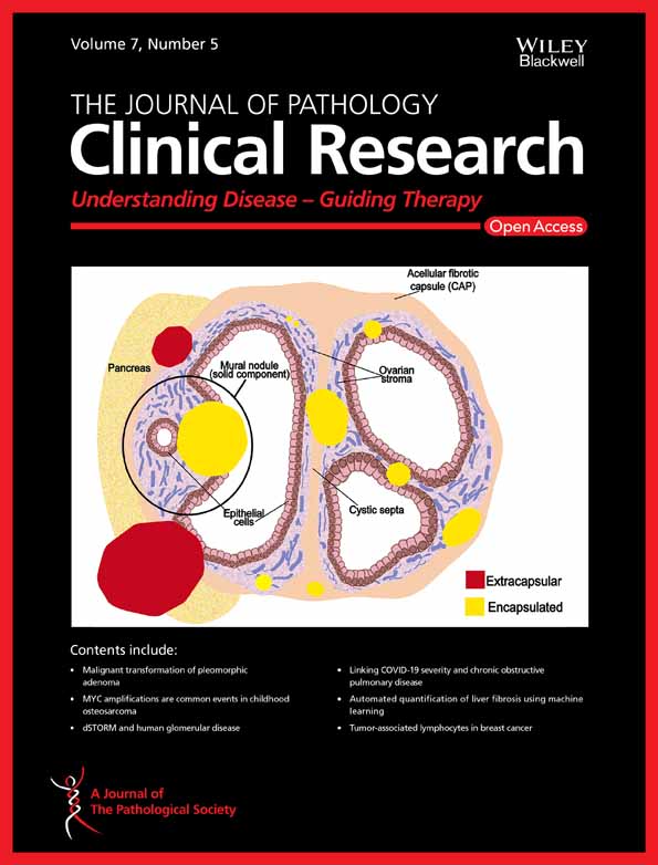 PD‐L1 expression in megakaryocytes and its clinicopathological features in primary myelofibrosis patients