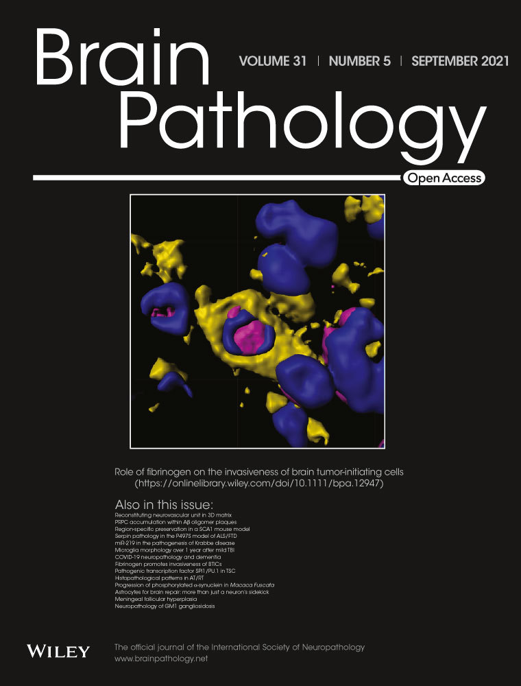 An 82‐year‐old man with a right frontal lobe rim‐enhancing lesion