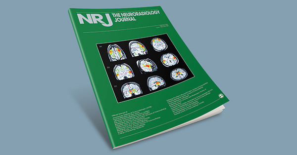 Correlation of dual energy computed tomography electron density measurements with cerebral glioma grade