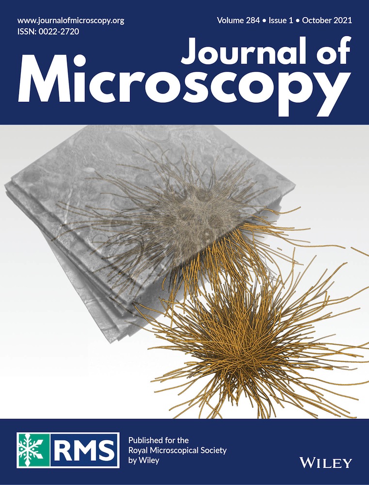 Fast, high precision autofocus on a motorised microscope: Automating blood sample imaging on the OpenFlexure Microscope