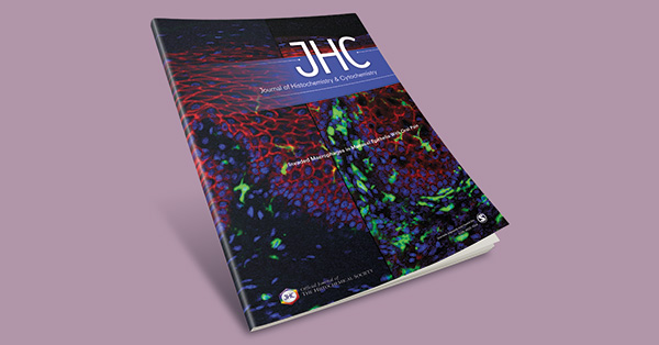 Carbonic Anhydrases II and IX in Non-ampullary Duodenal Adenomas and Adenocarcinoma