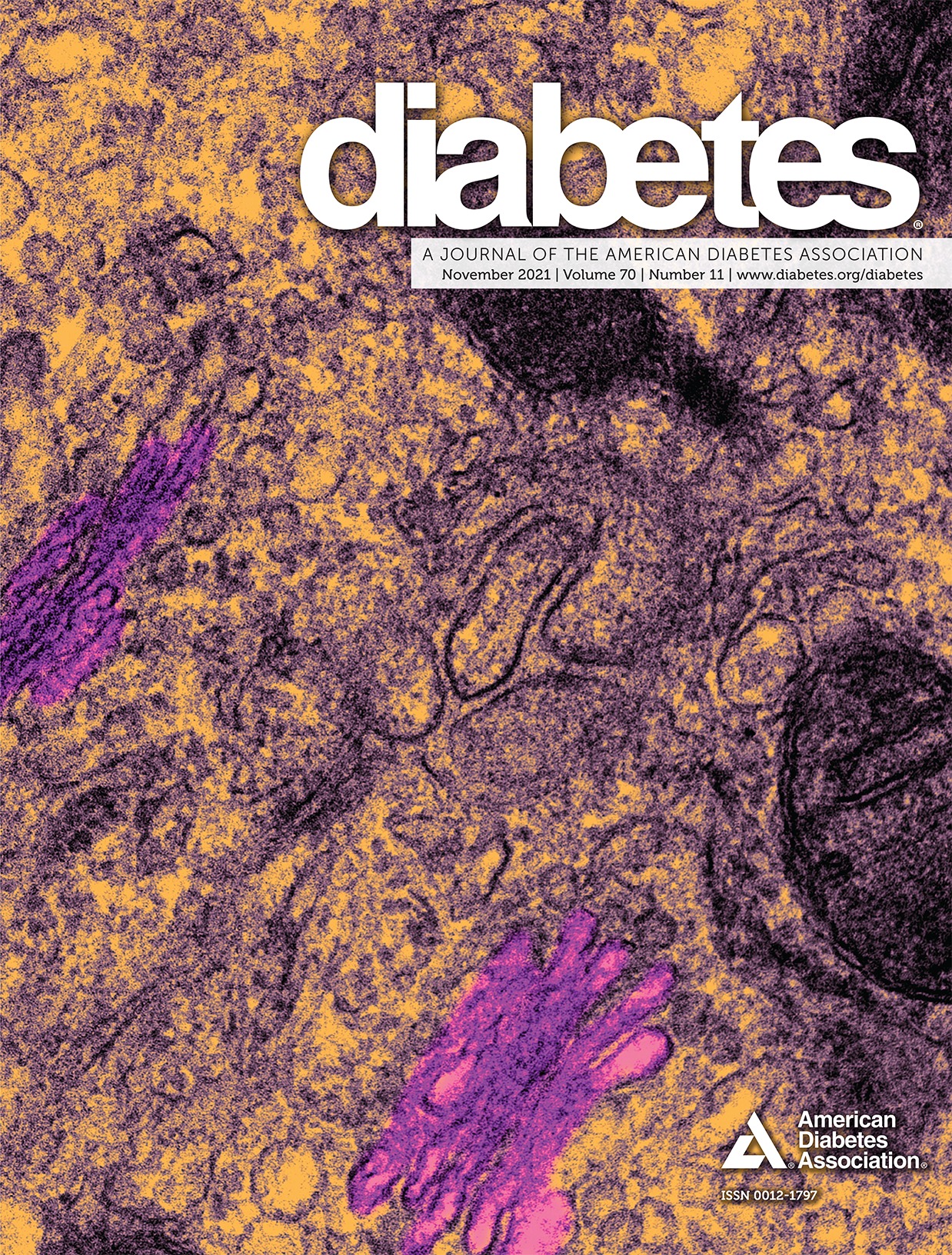 Leukocyte Counts and T-Cell Frequencies Differ Between Novel Subgroups of Diabetes and Are Associated With Metabolic Parameters and Biomarkers of Inflammation
