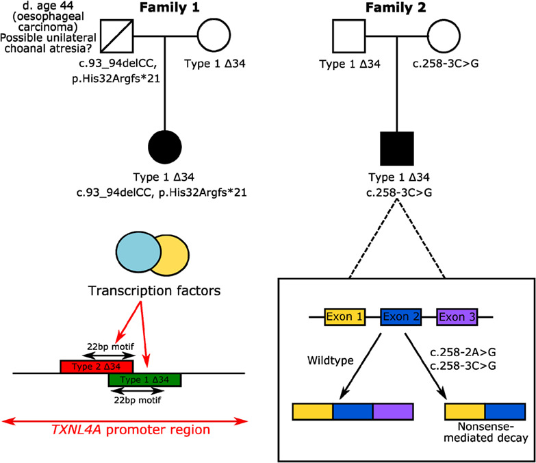 Expanding the genotypic spectrum of TXNL4A variants in Burn‐McKeown syndrome