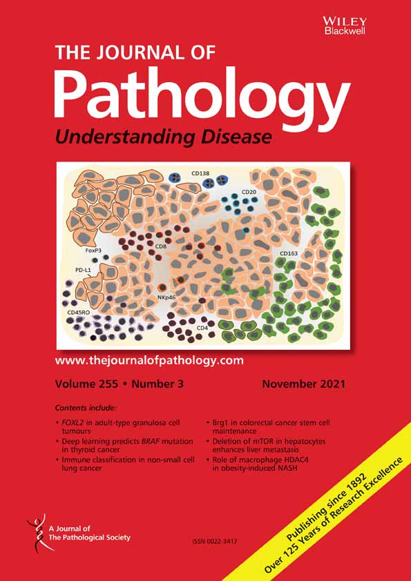 Tumor‐immune landscape patterns before and after chemoradiation in resectable esophageal adenocarcinomas