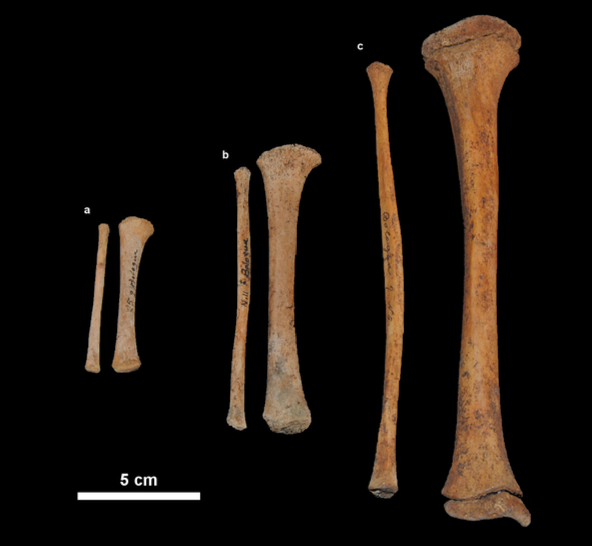 The relationship between bipedalism and growth: A metric assessment in a documented modern skeletal collection (Certosa Collection, Bologna, Italy)