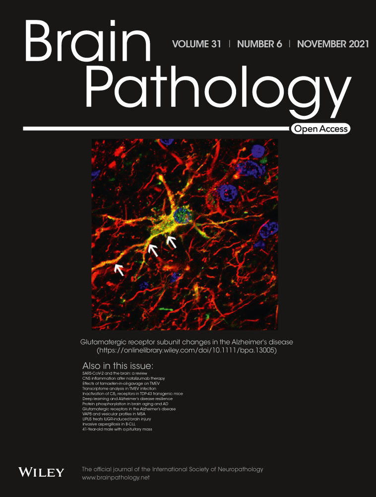 An elderly man with bilateral cavitary lesions in the globus pallidus