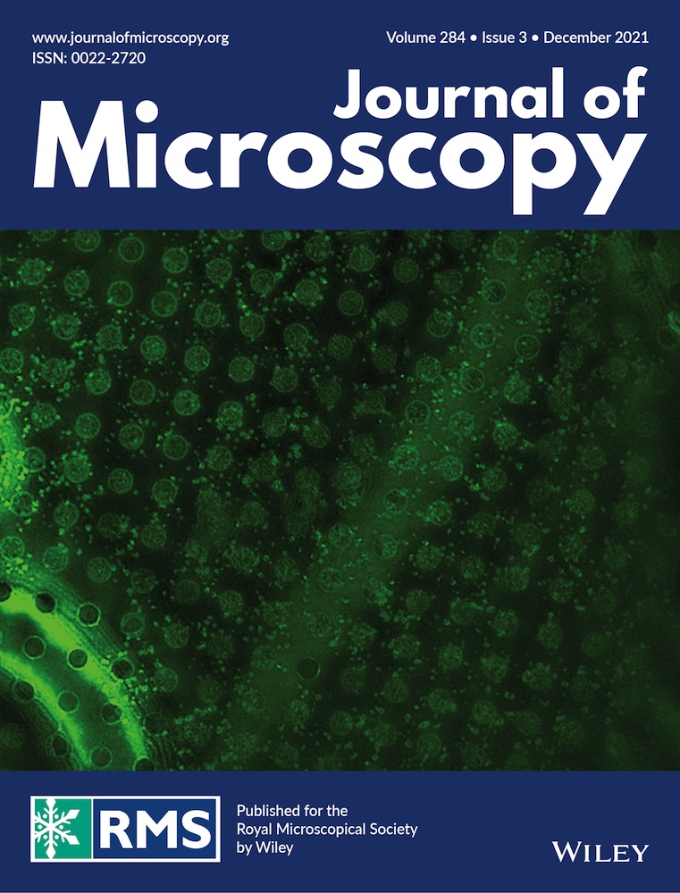 The Journal of Microscopy would like to thank all those referees who reviewed papers for the Journal during 2021. Your assistance and contribution to the Journal is greatly appreciated