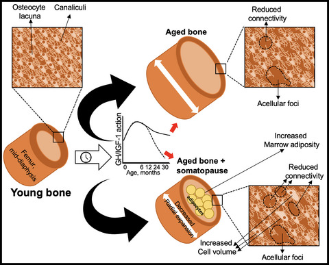 Induction of somatopause in adult mice compromises bone morphology and exacerbates bone loss during aging