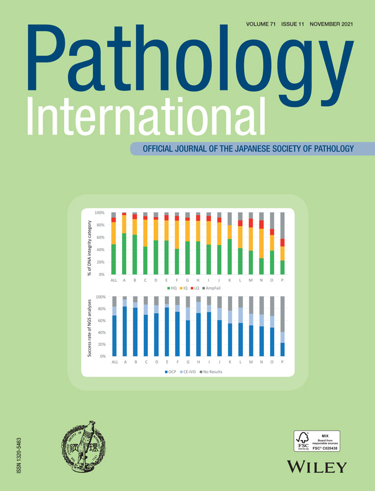 Clinicopathological and molecular analyses of hyperplastic lesions including microvesicular variant and goblet cell rich variant hyperplastic polyps and hyperplastic nodules—Hyperplastic nodule is an independent histological entity