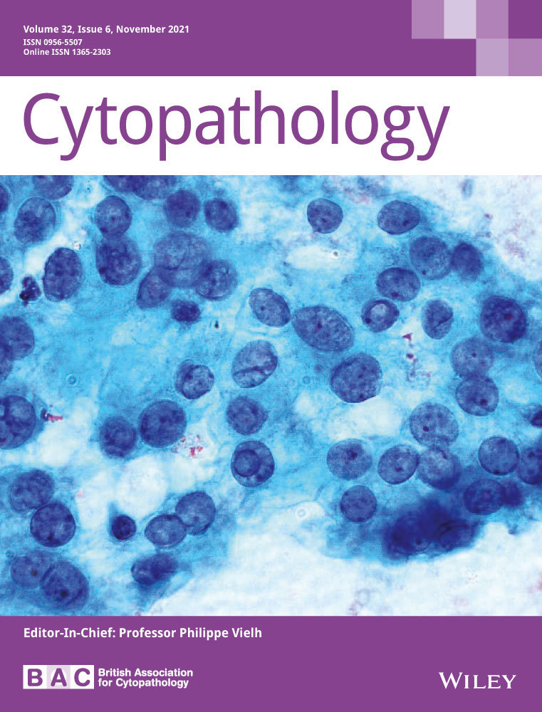 Cytodiagnosis of giant cell tumor presenting at unusual age and site with review of literature