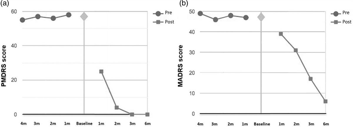 Remission of functional motor symptoms following esketamine administration in a patient with treatment-resistant depression: a single-case report