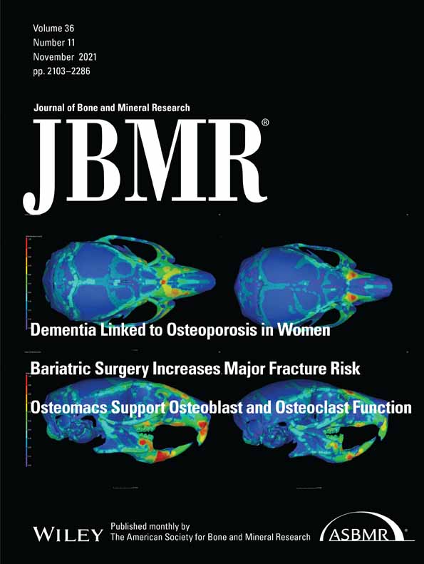 Introduction of a Cys360Tyr Mutation in ANO5 Creates a Mouse Model for Gnathodiaphyseal Dysplasia