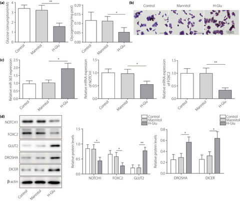 Micro ribonucleic acid‐363 regulates the phosphatidylinositol 3‐kinase/threonine protein kinase axis by targeting NOTCH1 and forkhead box C2, leading to hepatic glucose and lipids metabolism disorder in type 2 diabetes mellitus