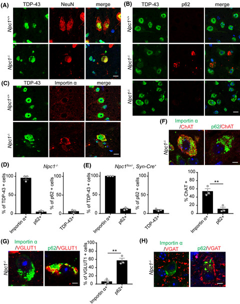 TDP‐43 proteinopathy occurs independently of autophagic substrate accumulation and underlies nuclear defects in Niemann‐Pick C disease