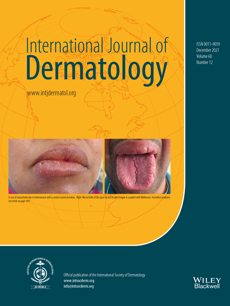 A rare case of unilateral acral speckled hypopigmentation