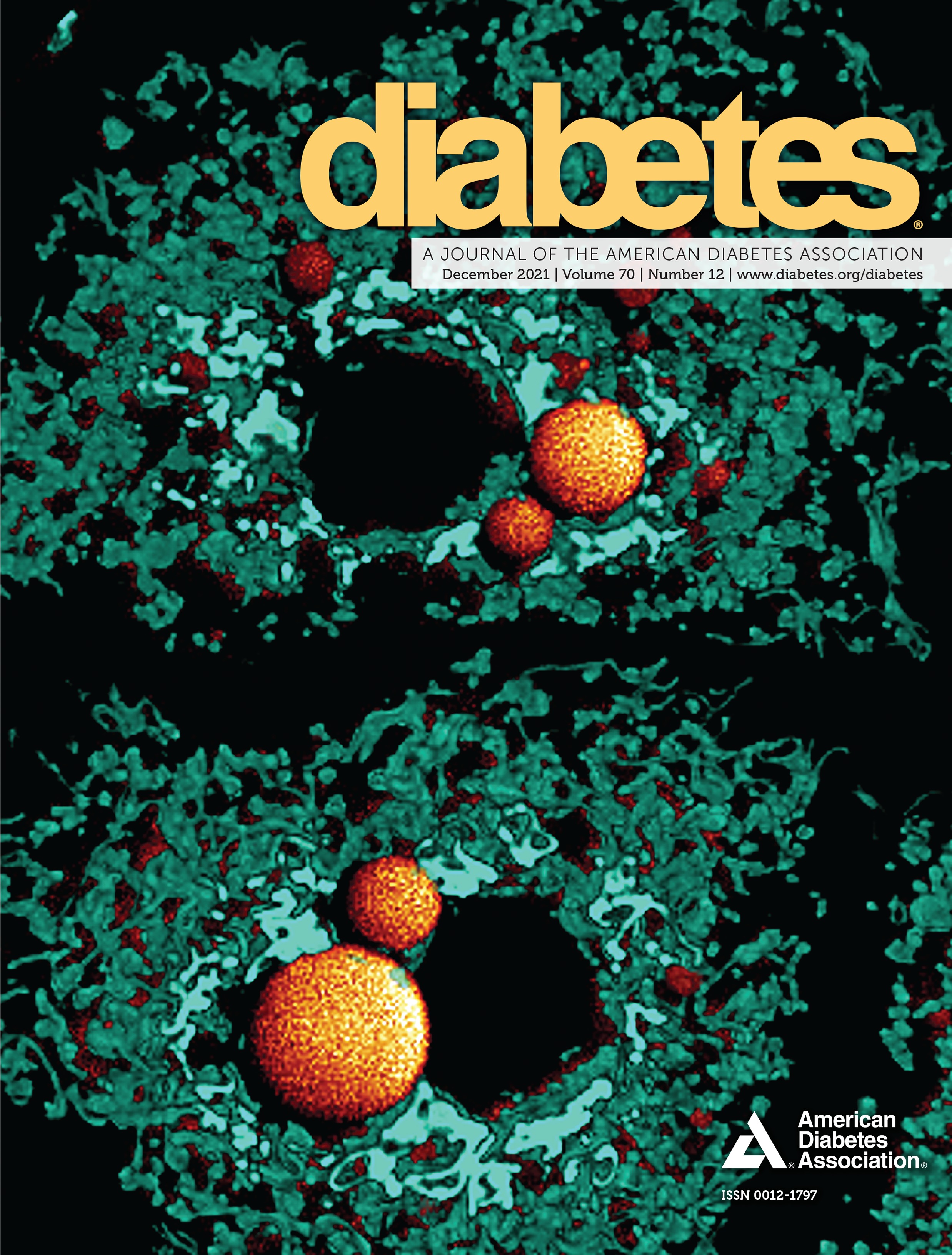 COVID-19-Induced New-Onset Diabetes: Trends and Technologies
