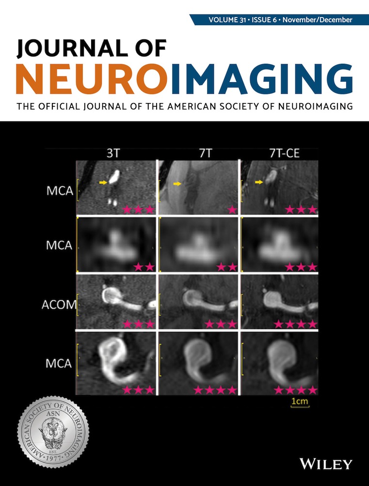 Sexual dimorphism in the cerebrovascular network: Brain MRI shows lower arterial density in women