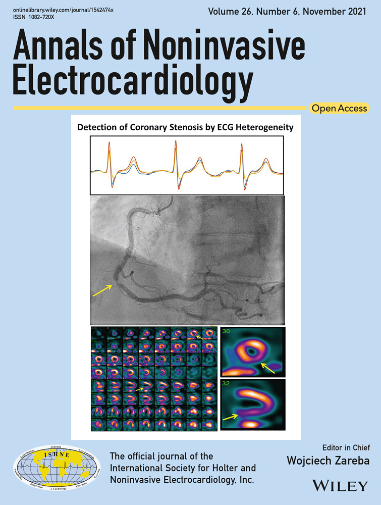 Ambulatory electrocardiographic markers predict serious cardiac events in patients with chronic kidney disease: The Japanese Noninvasive Electrocardiographic Risk Stratification of Sudden Cardiac Death in Chronic Kidney Disease (JANIES‐CKD) study