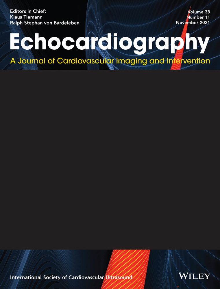 Impact of inter‐vendor variability on evaluation of left ventricular mechanical dispersion