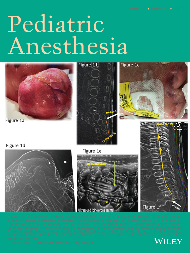 Modes of Ventilation for Pediatric Patients Under Anesthesia: A Pro/Con Conversation