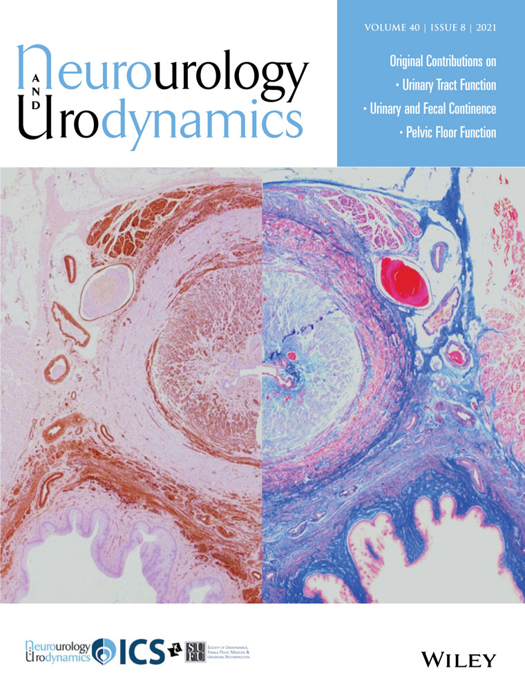 Reference values for urine flow parameters in normal female populations: Liverpool nomograms universally applicable after population‐specific comparisons