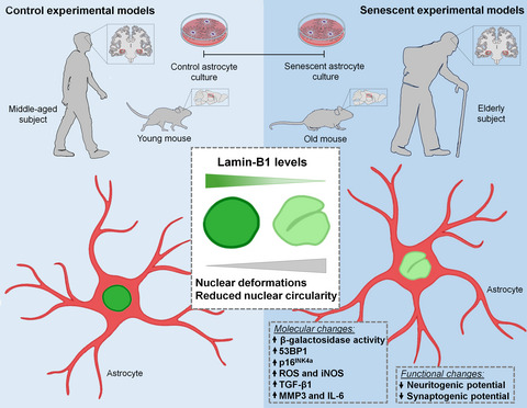 Loss of lamin‐B1 and defective nuclear morphology are hallmarks of astrocyte senescence in vitro and in the aging human hippocampus