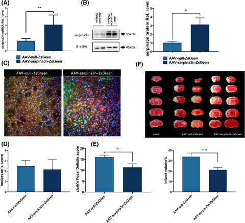 SerpinA3N attenuates ischemic stroke injury by reducing apoptosis and neuroinflammation