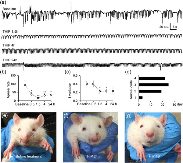 In vivo evidence for the cellular basis of central hypoventilation of Rett syndrome and pharmacological correction in the rat model