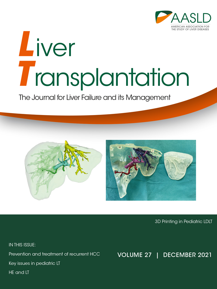 Decreased Urgency Among Liver Transplantation Candidates With Hepatocellular Carcinoma in the United States