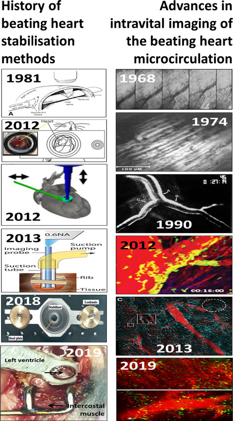 A historical review of experimental imaging of the beating heart coronary microcirculation in vivo