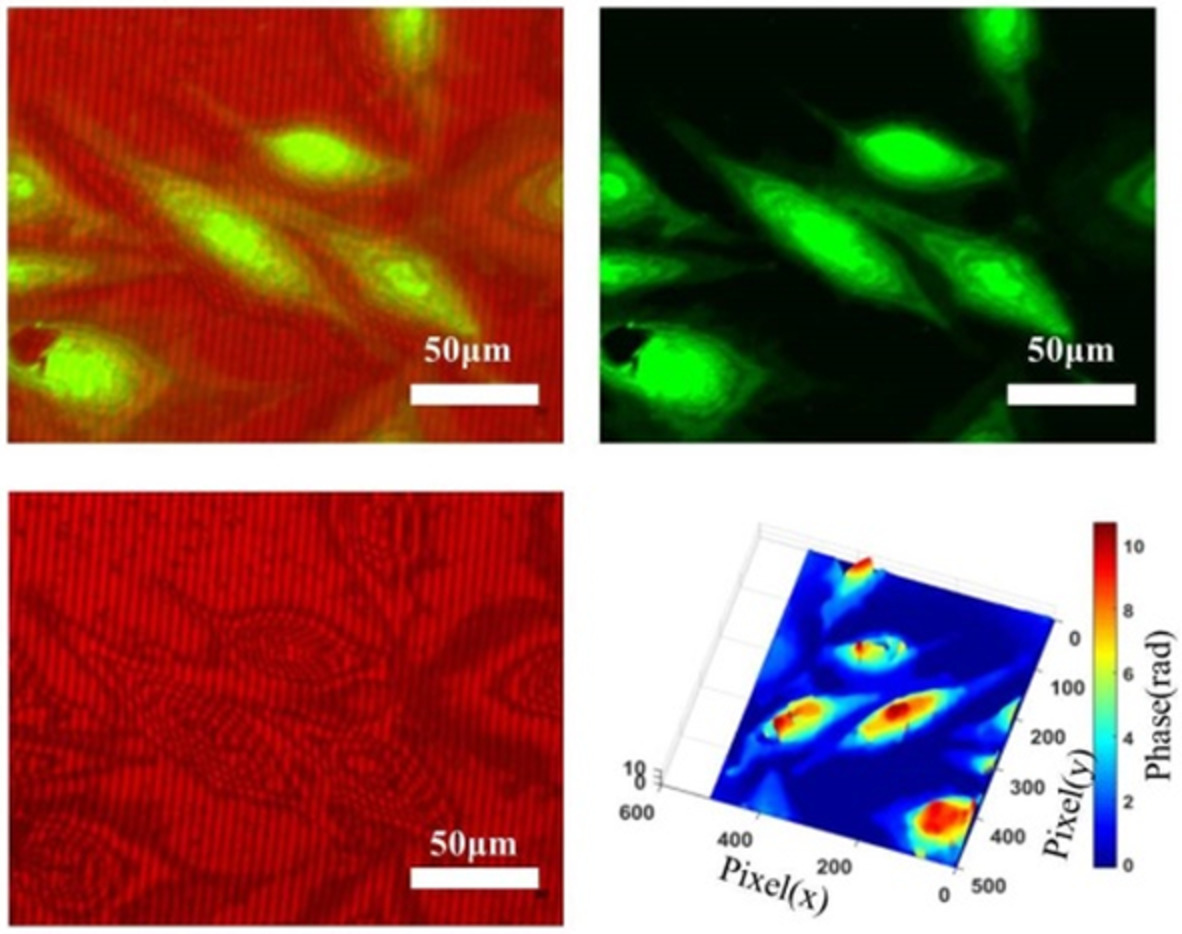 Multimodal biomicroscopic system for the characterization of cells with high spatial phase sensitivity and sub‐pixel accuracy