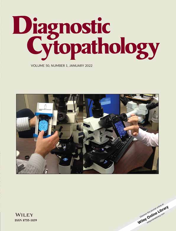 Nocardiosis diagnosed on bronchoalveolar lavage: Role of cytopathology