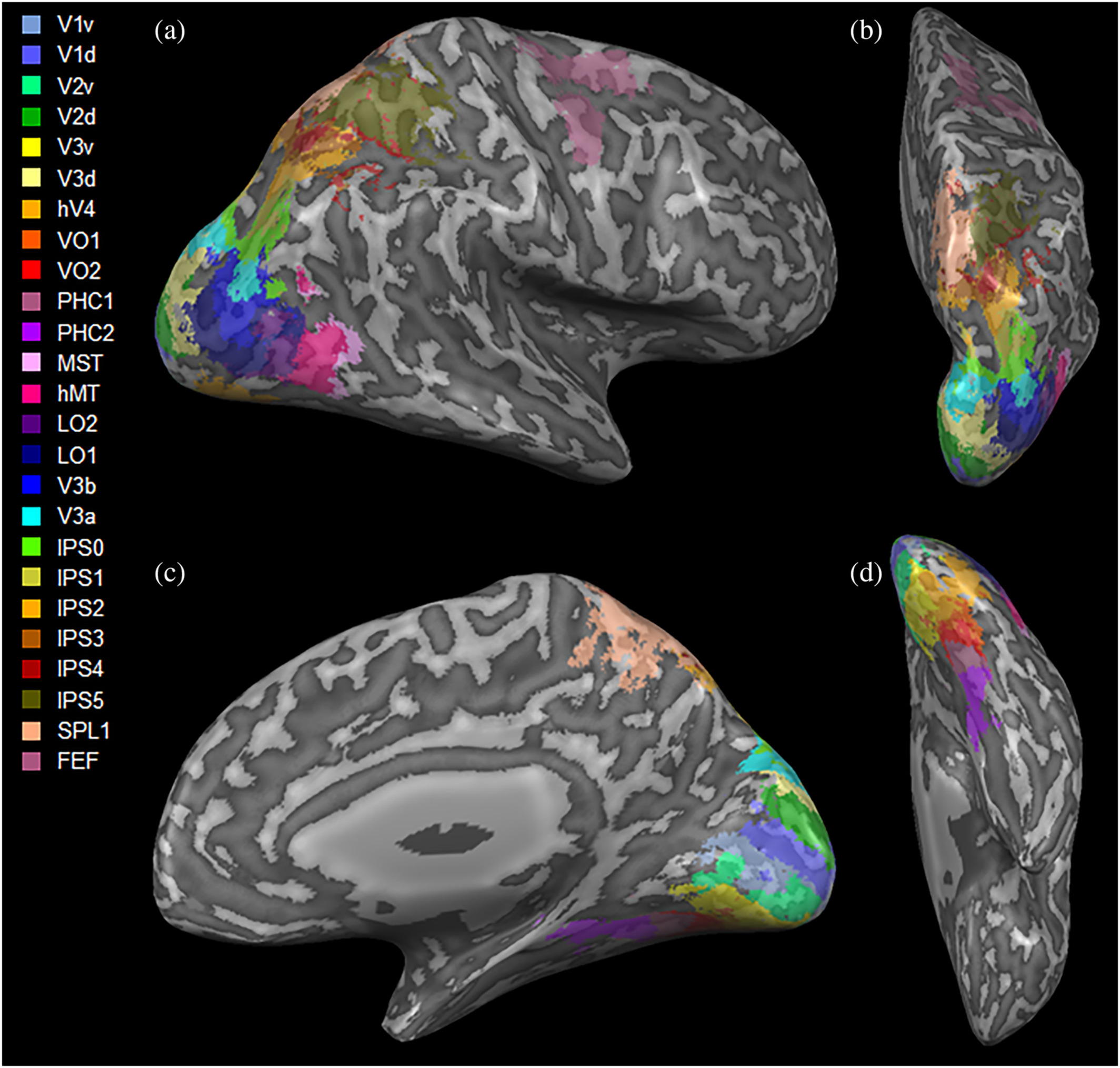 Anatomical and functional visual network patterns in progressive multiple sclerosis