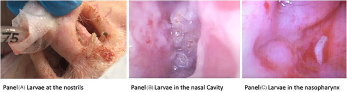 Nasal myiasis under direct bronchoscopic visualization