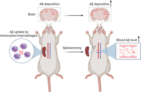 Physiological clearance of Aβ by spleen and splenectomy aggravates Alzheimer‐type pathogenesis